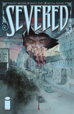 Severed #3